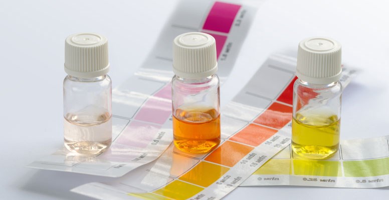 Do-it-yourself water test kit